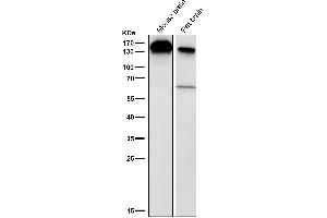 All lanes use the Antibody at 1:2K dilution for 1 hour at room temperature.