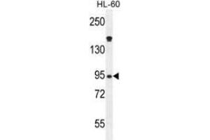 Western blot analysis in HL-60 cell line lysates (35ug/lane) using Myeloperoxidase Antibody (C-term). (Myeloperoxidase 抗体  (N-Term))