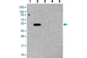 Western blot analysis of Lane 1: RT-4, Lane 2: U-251 MG, Lane 3: Human Plasma, Lane 4: Liver, Lane 5: Tonsil with TMEM39A polyclonal antibody  at 1:250-1:500 dilution. (TMEM39A 抗体)