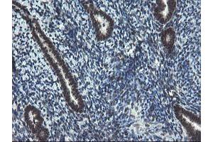 Image no. 2 for anti-Ubiquitin-Conjugating Enzyme E2E 3 (UBE2E3) antibody (ABIN1501618) (UBE2E3 抗体)