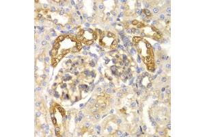 Immunohistochemistry of paraffin-embedded rat kidney using PYCARD antibody. (PYCARD 抗体)