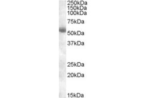 Western Blotting (WB) image for anti-Transmembrane Protease, serine 2 (TMPRSS2) (Internal Region) antibody (ABIN2466752) (TMPRSS2 抗体  (Internal Region))