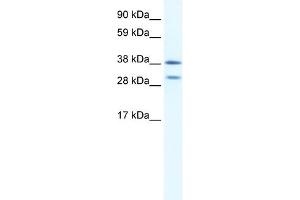 WB Suggested Anti-NKX2-3 Antibody Titration:  0. (NK2 Homeobox 3 抗体  (N-Term))