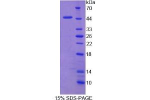 Image no. 1 for NCK Adaptor Protein 1 (NCK1) (AA 2-377) protein (His tag) (ABIN6238343) (NCK1 Protein (AA 2-377) (His tag))