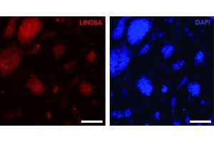Immunocytochemical analysis of LIN28A staining of mouse embryonic stem cells. (LIN28A 抗体  (C-Term))