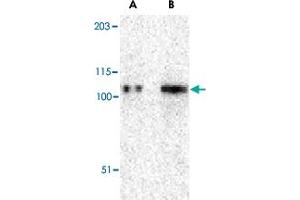 Western blot analysis of TRPC6 in K-562 cell lysate with TRPC6 polyclonal antibody  at (A) 0. (TRPC6 抗体  (N-Term))