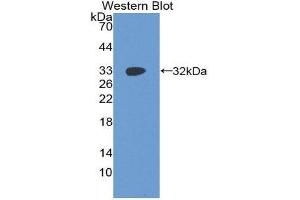 Western Blotting (WB) image for anti-Insulin-Like Growth Factor 2 mRNA Binding Protein 2 (IGF2BP2) (AA 141-384) antibody (ABIN1859297) (IGF2BP2 抗体  (AA 141-384))