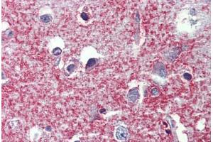 Human Brain, cortex: Formalin-Fixed, Paraffin-Embedded (FFPE) (SHROOM2 抗体  (AA 1554-1616))