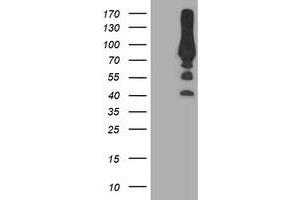 Western Blotting (WB) image for anti-phosphofructokinase, Platelet (PFKP) antibody (ABIN1500165) (PFKP 抗体)