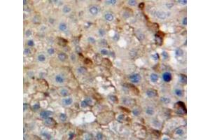 Used in DAB staining on fromalin fixed paraffin-embedded liver tissue (DDOST 抗体  (AA 29-412))