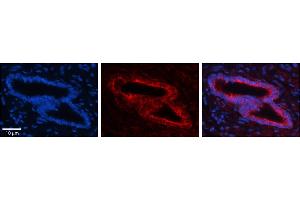 Rabbit Anti-SLBP Antibody     Formalin Fixed Paraffin Embedded Tissue: Human Bronchial Epithelial Tissue  Observed Staining: Cytoplasmic  Primary Antibody Concentration: 1:100  Secondary Antibody: Donkey anti-Rabbit-Cy3  Secondary Antibody Concentration: 1:200  Magnification: 20X  Exposure Time: 0. (SLBP 抗体  (Middle Region))