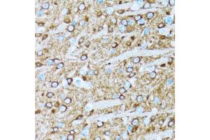 Immunohistochemistry of paraffin-embedded rat brain using ENO2 antibody (ABIN5971596) at dilution of 1/100 (40x lens). (ENO2/NSE 抗体)