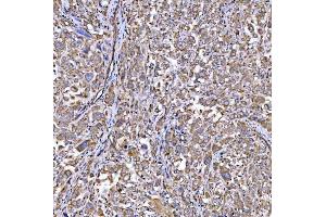 IHC analysis of RAB3GAP1 using anti-RAB3GAP1 antibody (ABIN7599702).