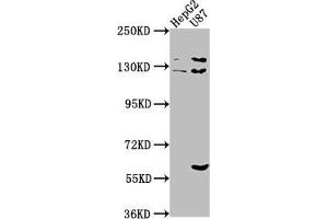 Western Blot Positive WB detected in: HepG2 whole cell lysate, U87 whole cell lysate All lanes: ST5 antibody at 1:2000 Secondary Goat polyclonal to rabbit IgG at 1/50000 dilution Predicted band size: 127, 83, 71 kDa Observed band size: 127 kDa (ST5 抗体  (AA 3-280))