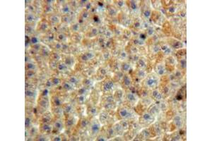 Used in DAB staining on fromalin fixed paraffin-embedded Liver tissue (SERPINB3 抗体  (AA 1-210))