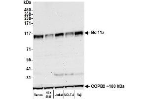 anti-B-Cell CLL/lymphoma 11A (Zinc Finger Protein) (BCL11A) (AA 1-50) antibody