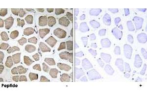 Immunohistochemistry analysis of paraffin-embedded human skeletal muscle tissue using SLC16A12 polyclonal antibody . (SLC16A12 抗体)