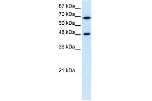 RRP9 antibody used at 5 ug/ml to detect target protein. (RRP9 抗体  (Middle Region))