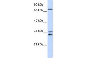 Image no. 1 for anti-Tousled-Like Kinase 2 (TLK2) (AA 176-225) antibody (ABIN6744261) (TLK2 抗体  (AA 176-225))