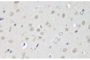 Immunohistochemistry of paraffin-embedded Rat brain using CTCF Polyclonal Antibody at dilution of 1:200 (40x lens). (CTCF 抗体)