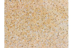 ABIN6257890 and ABIN6274946 at 1/100 staining Rat brain tissue by IHC-P. (CAGE1 抗体  (C-Term))