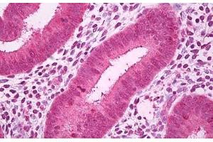 Anti-GALNT7 antibody IHC staining of human uterus, endometrium. (GALNT7 抗体)