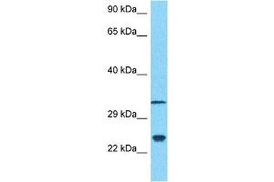 Host:  Rabbit  Target Name:  NCS1  Sample Type:  MDA-MB-435s Whole Cell lysates  Antibody Dilution:  1. (NCS1 抗体  (N-Term))
