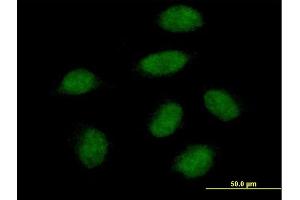 Immunofluorescence of purified MaxPab antibody to SNAI1 on HeLa cell. (SNAIL 抗体  (AA 1-264))