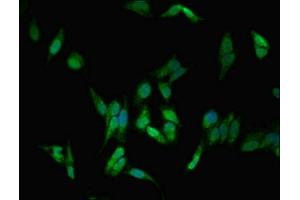 Immunofluorescent analysis of Hela cells using ABIN7150068 at dilution of 1:100 and Alexa Fluor 488-congugated AffiniPure Goat Anti-Rabbit IgG(H+L) (DLG1 抗体  (AA 662-773))