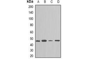 Western blot analysis of NAP1L1 expression in TH29 (A), SKOV3 (B), NIH3T3 (C), mouse spleen (D) whole cell lysates. (NAP1L1 抗体)