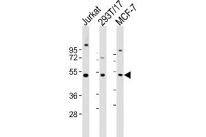 All lanes : Anti-VRK1 antibody at 1:2000 dilution Lane 1: Jurkat whole cell lysates Lane 2: 293T/17 whole cell lysates Lane 3: MCF-7 whole cell lysates Lysates/proteins at 20 μg per lane. (VRK1 抗体  (AA 366-396))