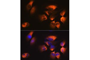 Immunofluorescence analysis of U-251MG cells using M1 Rabbit mAb (ABIN7265448) at dilution of 1:100 (40x lens). (AP2M1 抗体)