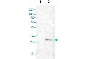 Western blot analysis of Lane 1: Negative control (vector only transfected HEK293T lysate), Lane 2: Over-expression lysate (Co-expressed with a C-terminal myc-DDK tag (~3. (FAM82B 抗体)