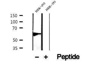 Western blot analysis of extracts of HEK-293 cells, using PHF17 antibody. (PHF17 抗体  (C-Term))