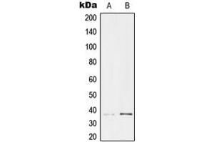 Western blot analysis of TCF19 expression in HeLa (A), HEK293 (B) whole cell lysates. (TCF19 抗体  (Center))