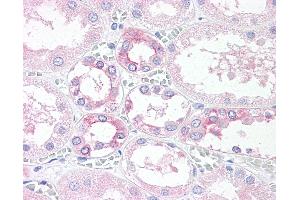 Anti-TM9SF4 antibody IHC of human, kidney. (TM9SF4 抗体  (Internal Region))