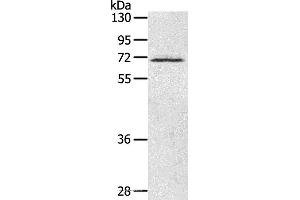 Western blot analysis of Human fetal brain tissue, using LTA4H Polyclonal Antibody at dilution of 1:500 (LTA4H 抗体)