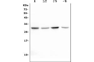 Western blot analysis of EPO using anti-EPO antibody (ABIN6719435). (EPO 抗体  (AA 28-193))