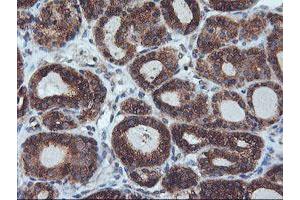 Image no. 9 for anti-IlvB (Bacterial Acetolactate Synthase)-Like (ILVBL) antibody (ABIN1498878)