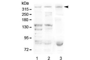 Western blot testing of Dystrophin antibody and Lane 1:  human SMMC-7721 (Dystrophin 抗体  (AA 3076-3404))