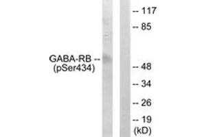 Western blot analysis of extracts from COS7 cells, using GABA-RB (Phospho-Ser434) Antibody. (GABA-RB (AA 401-450), (pSer434) 抗体)