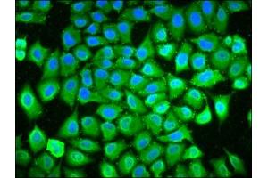Immunofluorescence staining of Hela cells with ABIN7163852 at 1:133, counter-stained with DAPI. (POLDIP3 抗体  (AA 100-221))