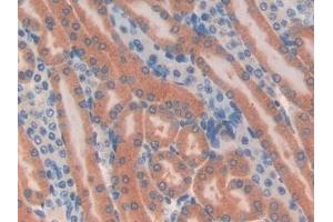 Detection of TUBd in Mouse Kidney Tissue using Polyclonal Antibody to Tubulin Delta (TUBd) (TUBD1 抗体  (AA 236-455))