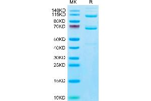 Human Complement component 3 Protein on Tris-Bis PAGE under reduced condition. (C3 Protein (AA 23-1663) (His tag))