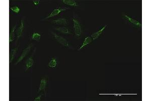 Immunofluorescence of purified MaxPab antibody to TIMM44 on HeLa cell. (TIMM44 抗体  (AA 1-452))