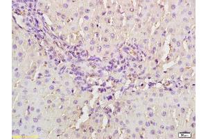 Formalin-fixed and paraffin embedded rat liver labeled with Anti- MASP2 Polyclonal Antibody, Unconjugated (ABIN676223) at 1:200, followed by conjugation to the secondary antibody and DAB staining. (MASP2 抗体  (AA 351-450))