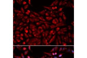 Immunofluorescence analysis of U2OS cells using NR1I3 Polyclonal Antibody (NR1I3 抗体)