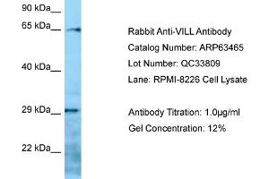 Western Blotting (WB) image for anti-Villin-Like (VILL) (N-Term) antibody (ABIN2789509) (VILL 抗体  (N-Term))