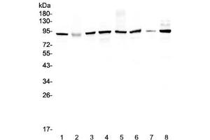 Western blot testing of human 1) HeLa 2) placenta, 3) MCF7, 4) A549, 5) SK-OV-3, 6) 22RV1, 7) A431 and 8) COLO320 lysate with UBA2 antibody at 0. (UBA2 抗体)