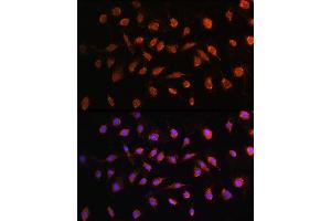 Immunofluorescence analysis of L929 cells using STK38 antibody (ABIN6132692, ABIN6148616, ABIN6148617 and ABIN6224215) at dilution of 1:100.